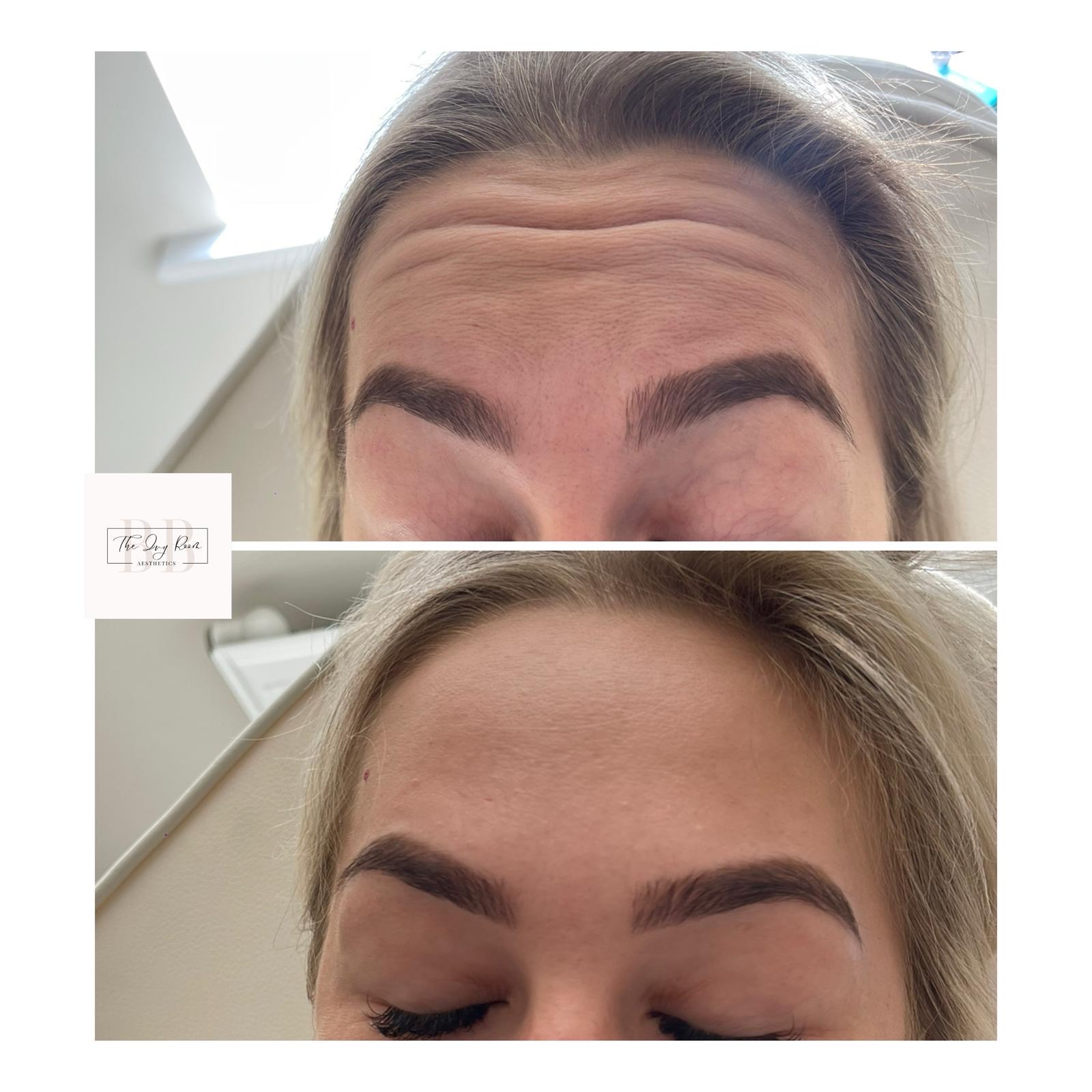 aesthetic-beforeandafter1